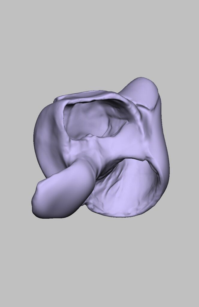 Diseño y fabricación de guantes especiales para atletismo en silla de ruedas